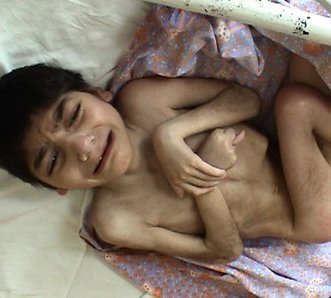 Copy of Romanian orphan